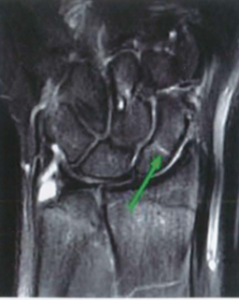 16.11 Hình ảnh CT scan cổ tay