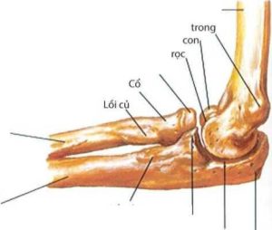 Gãy mỏm khuỷu là gãy xương phạm khớp.