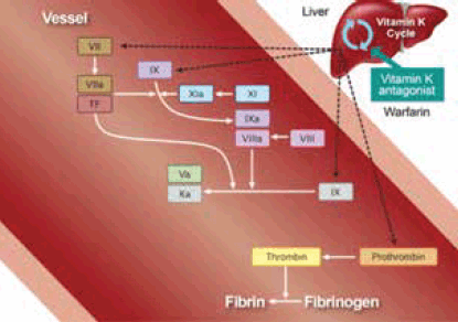 NOAC (New Oral Anticoagulants) – thuốc kháng đông đường uống thế hệ mới có gì đặc biệt?