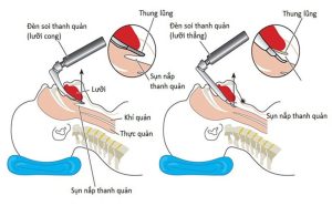 Hồi sinh tim phổi