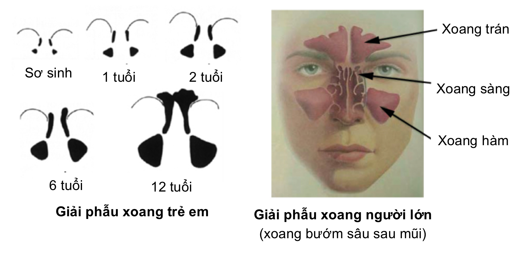Các xoang cạnh mũi ở trẻ em và người lớn