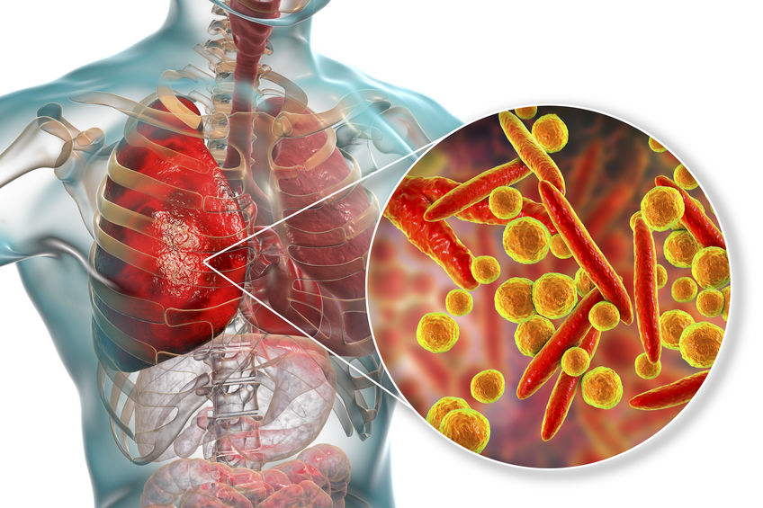 Mycoplasma pneumoniae là nguyên nhân thường gặp gây viêm phổi không điển hình ở trẻ em