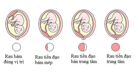 phan-loai-rau-tien-dao-theo-giai-phau