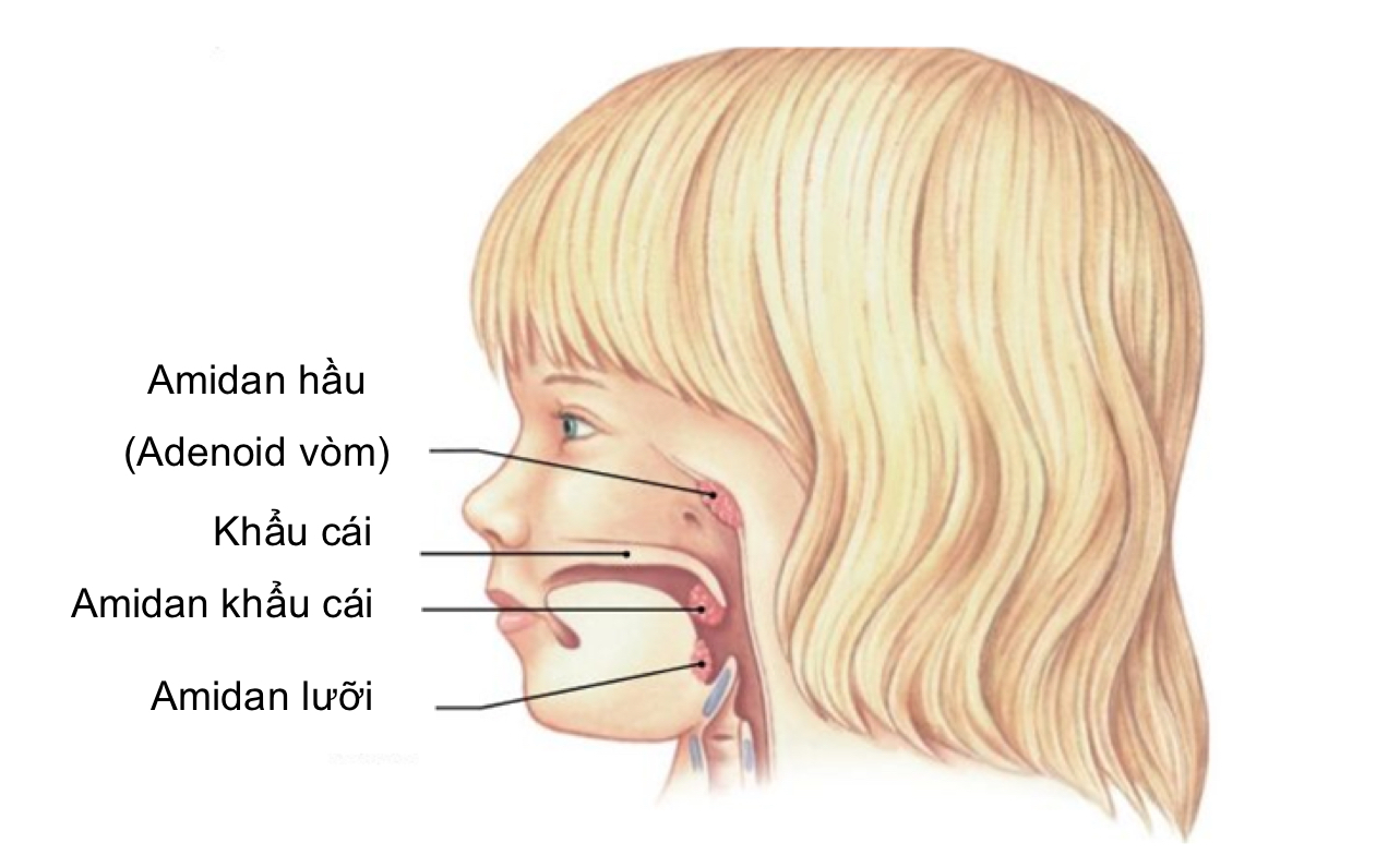 Vị trí các amidan vùng hầu