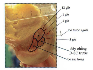 Vị tri giải phẫu diện bám đùi của DCCS và các bỏ cấu thành