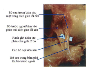 cấu trúc hai bỏ của DCCS