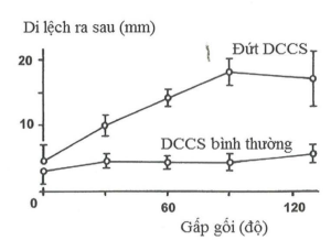 So sánh sự di lệch ra sau cùa xương chày so với xương đùi ở người bình thường và ớ người bị tổn thương DCCS trong quá trình gấp duỗi khớp gối 