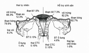 Các vị trí TNTC