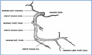 Giải phẫu động mạch vành phải