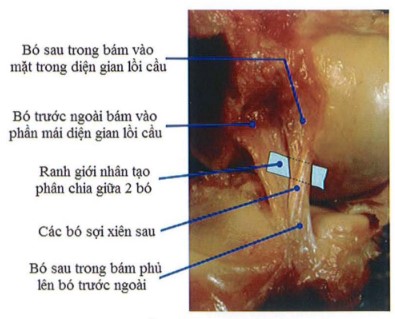 Cấu trúc 2 bó của DCCS