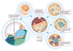 Cơ chế hoạt động của Lecanemab