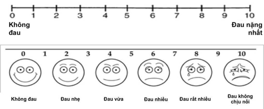 Xử lý đau ở trẻ bại não