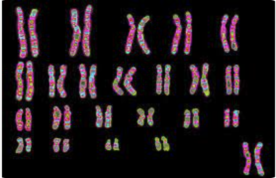 Karyotype