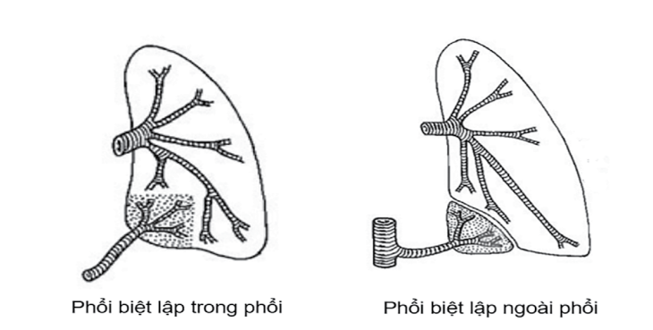 phoi-biet-lap