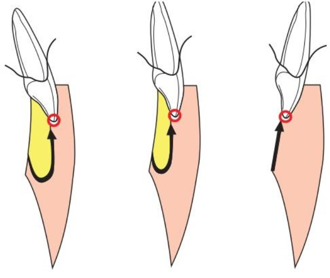 di-chuyen-loi-cau-2