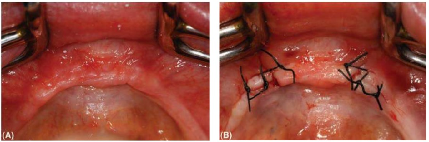 dat-abutment-2