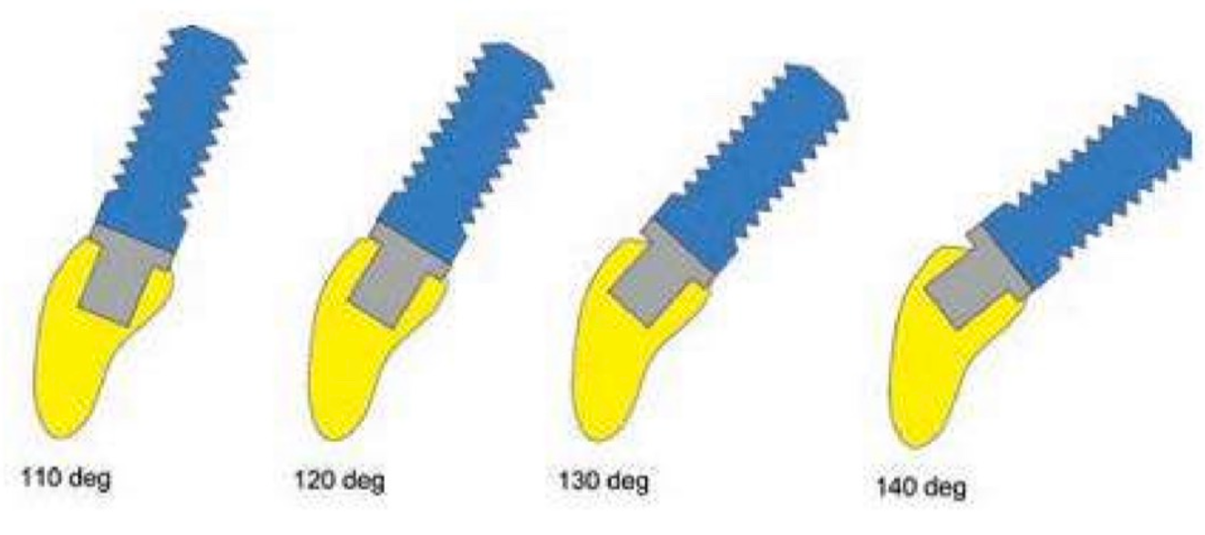 goc-cua-implant