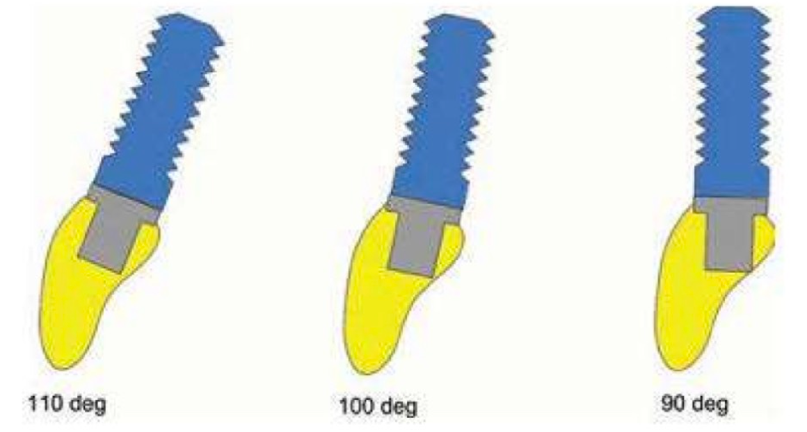 goc-cua-implant-2