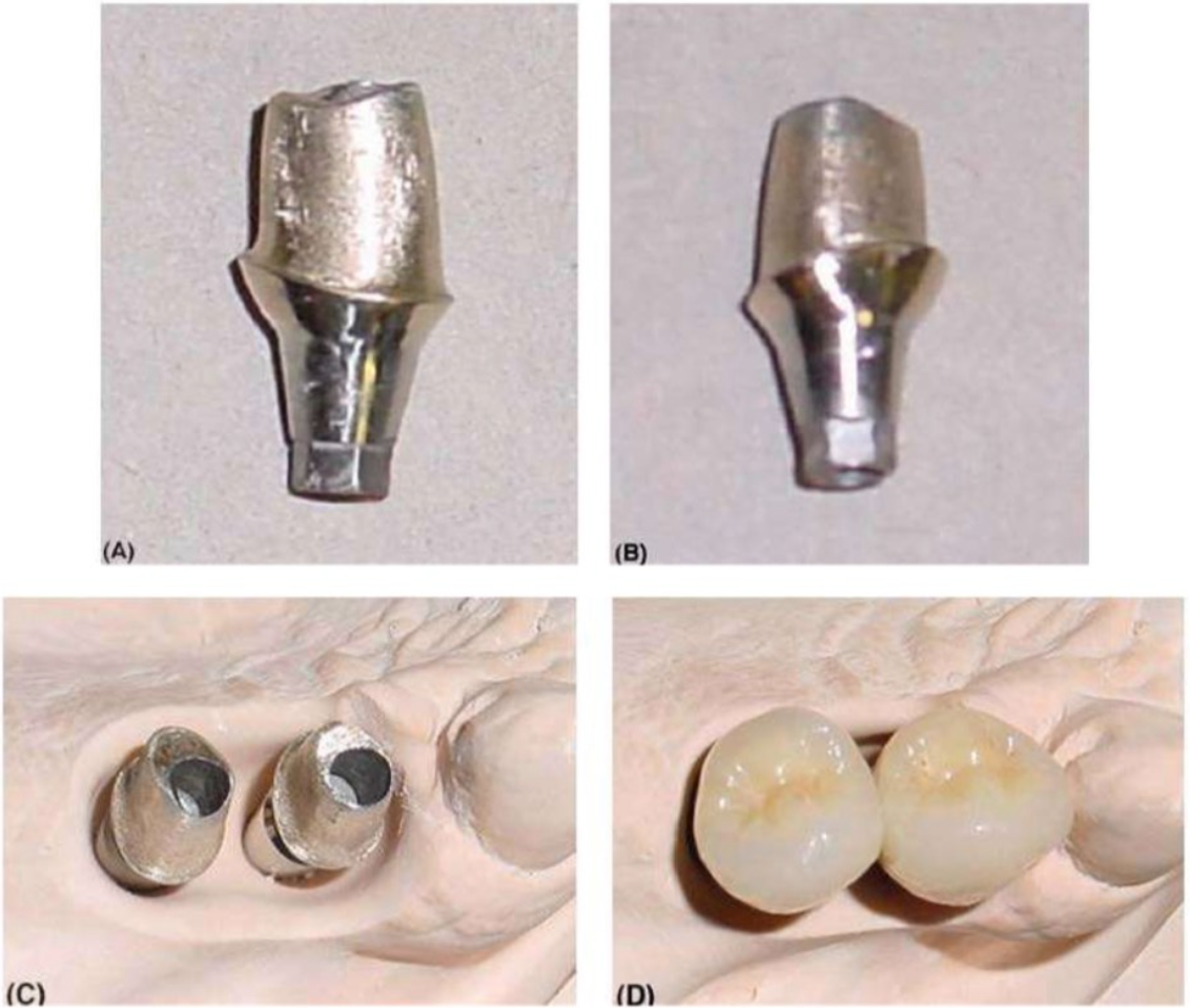 abutment-tuy-bien-4