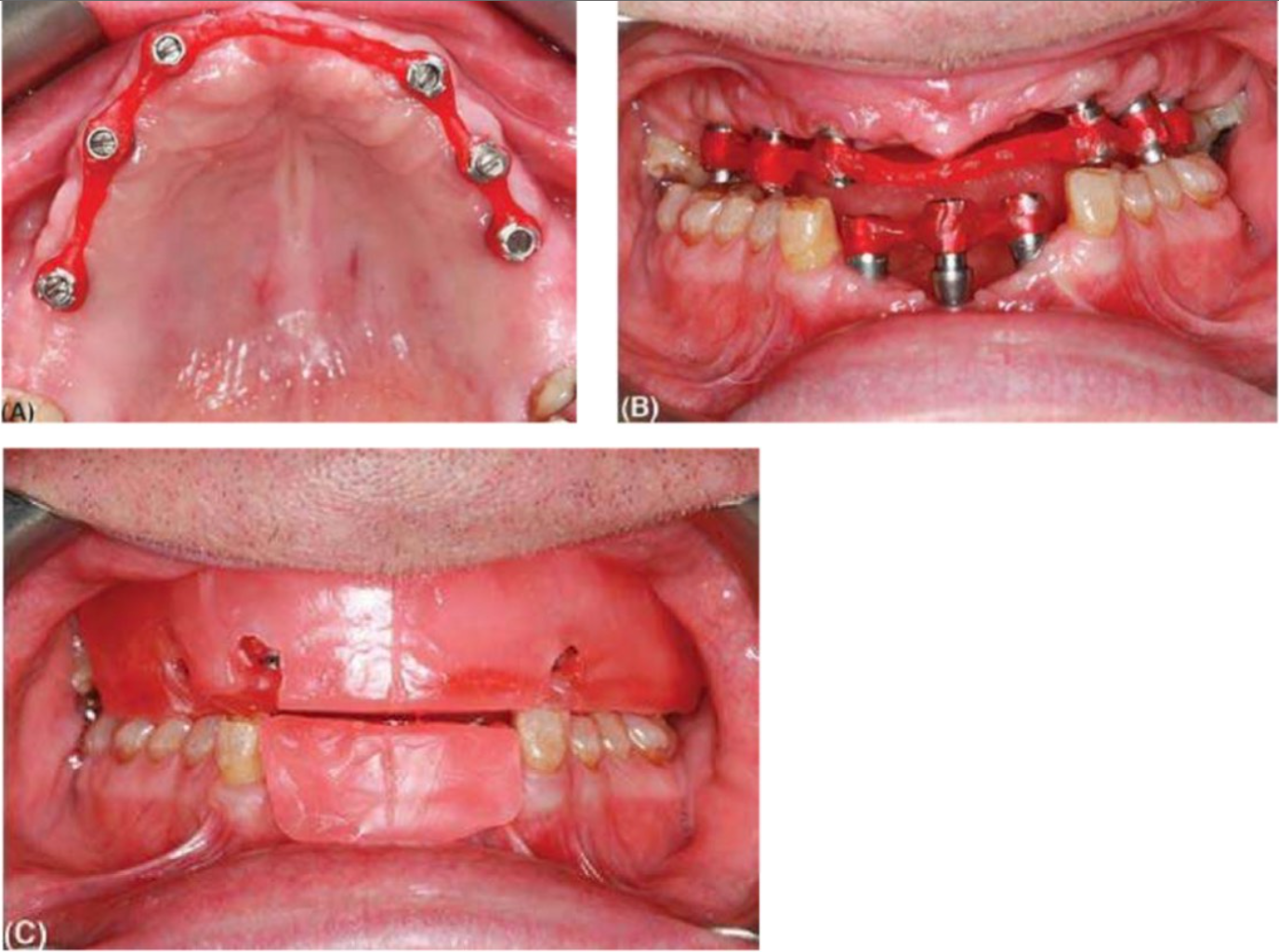 phuc-hinh-cau-rang-1