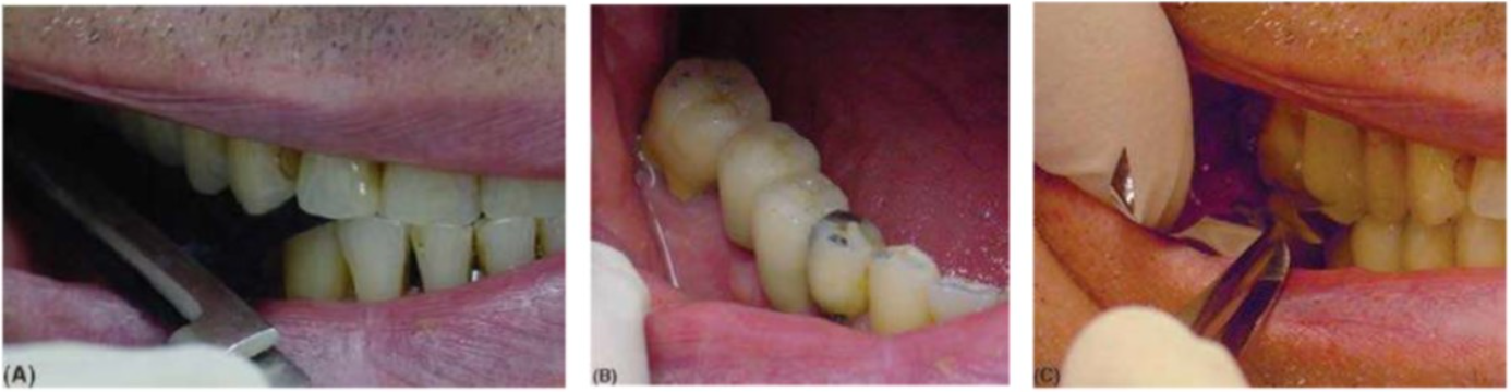 phuc-hinh-cau-rang-2