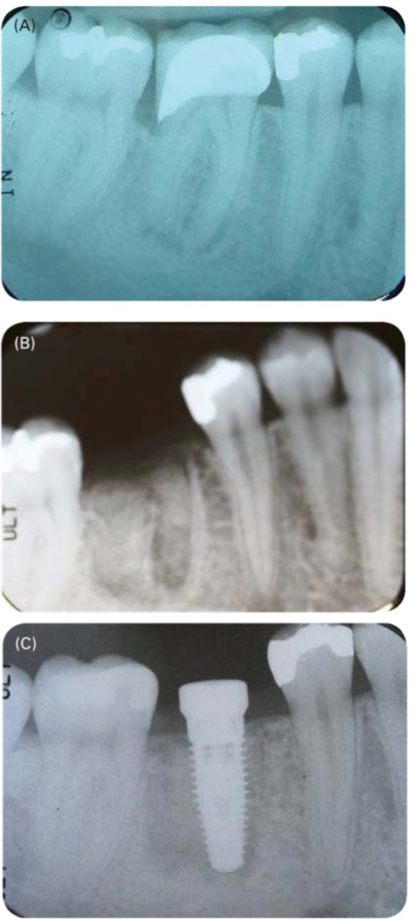 case-lam-sang-1-4