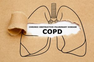 COPD có một số kiểu hình thường gặp trên bệnh nhân