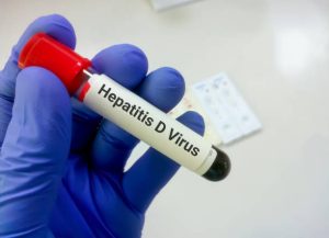 Virus viêm gan D chỉ có thể tồn tại trong cơ thể của những người nhiễm virus viêm gan B (HBV),