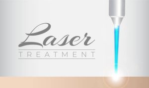 Sử dụng laser công suất thấp là một phương pháp không xâm lấn và không đau để giảm đau thần kinh.