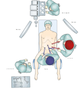 Tư thế cắt đại tràng