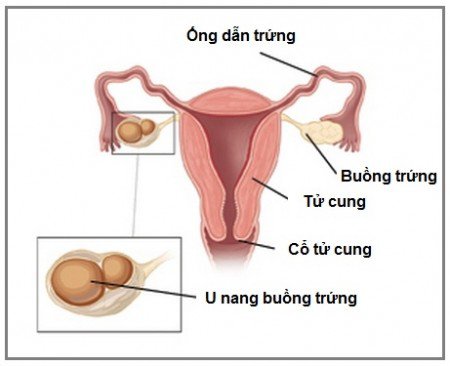 u-nang-buong-trung