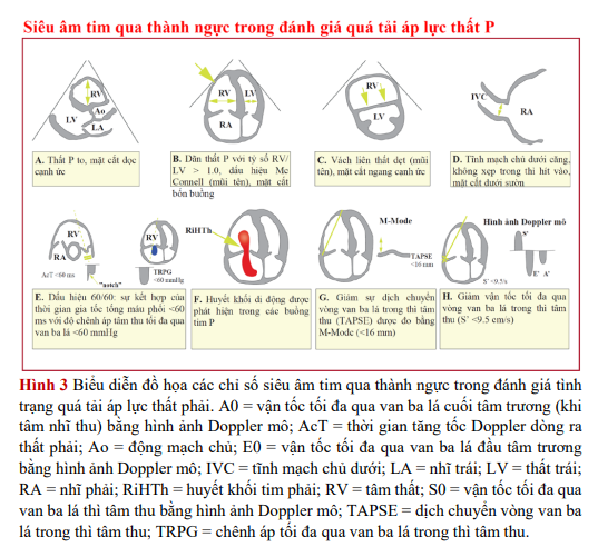 sieu-am-tim-qua-thanh-nguc-danh-gia-qua-tai-ap-luc