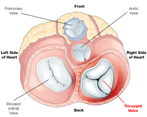 Bệnh van động mạch phổi