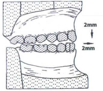 thiet-lap-khop-can-1