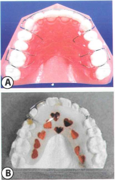 khi-cu-duy-tri-1