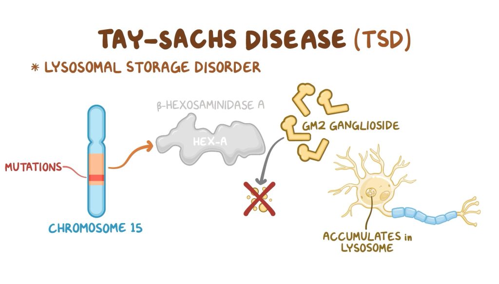 nguyên nhân gây bệnh Tay Sachs