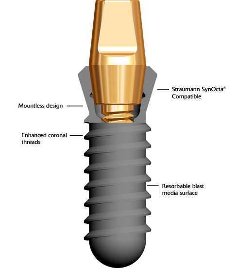 dat-implant-mot-thi
