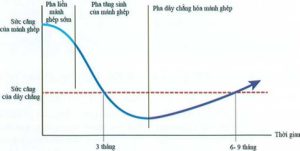 Phục hồi chức năng sau phẫu thuật