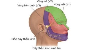 dau-day-than-kinh-sinh-ba