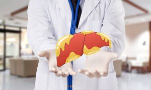 Gan nhiễm mỡ có thể là yếu tố nguy cơ của nhiều bệnh lý